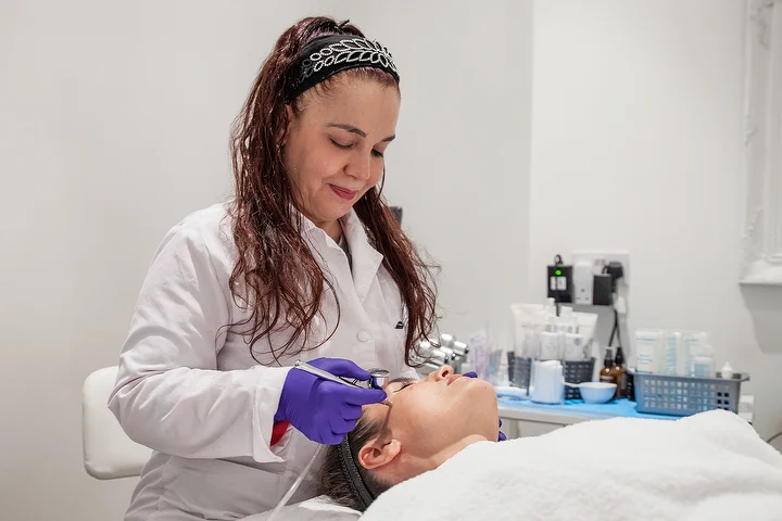 SkinPen microneedling treatment in progress