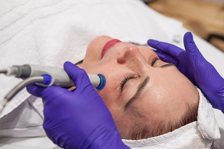 Patient receiving microneedling treatment